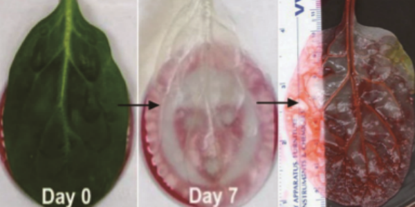 The Process of Developing Heart Tissue with Spinach Cell / insight.co.kr
